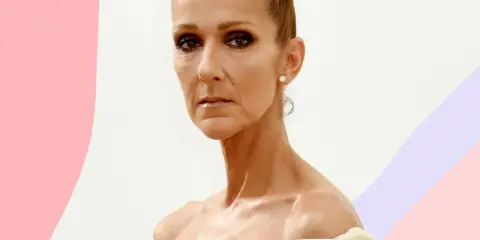 Celine Dion, con un'espressione pensierosa, affronta la sua malattia con forza.