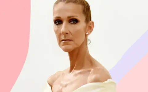 Celine Dion, con un'espressione pensierosa, affronta la sua malattia con forza.