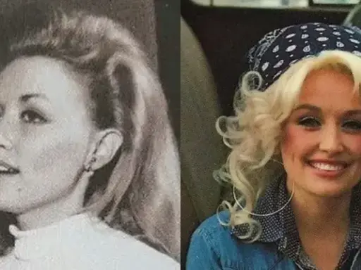Dolly Parton senza parrucca, in un ritratto in bianco e nero e uno a colori con bandana.